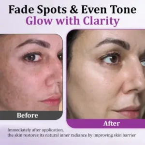 Ceoerty® MelantraX Advanced Anti-Hyperpigmentation Essence