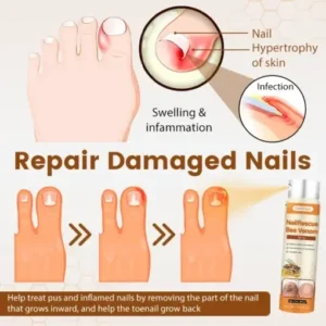 Ceoerty® NailRescue Bee Venom Spray