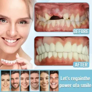 Ceoerty™ Official Store Advanced Full Denture Set