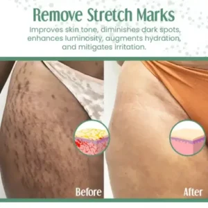 Ceoerty™ RelastiSkin Advanced Skin Firming Cream